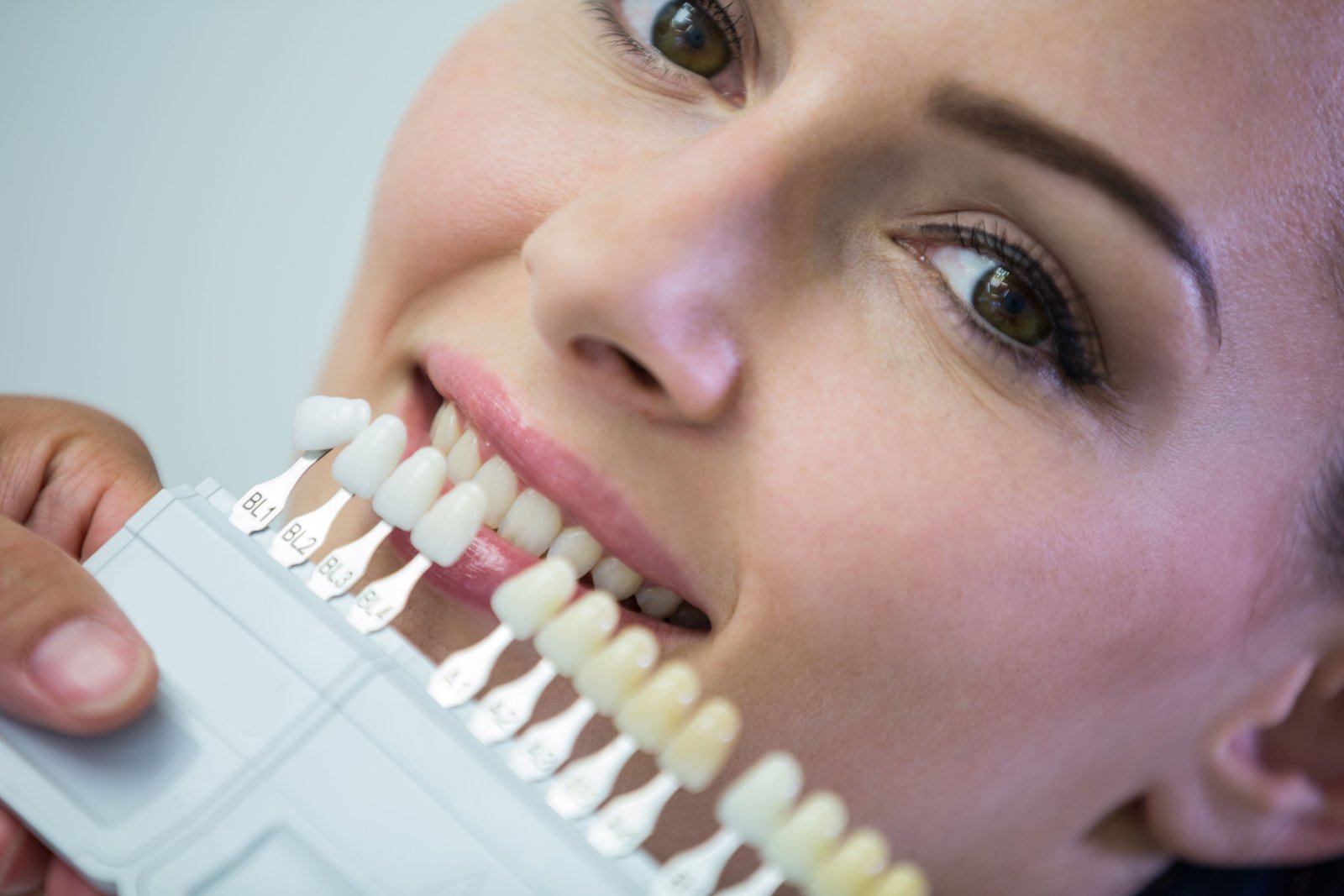 Full Mouth dental implants