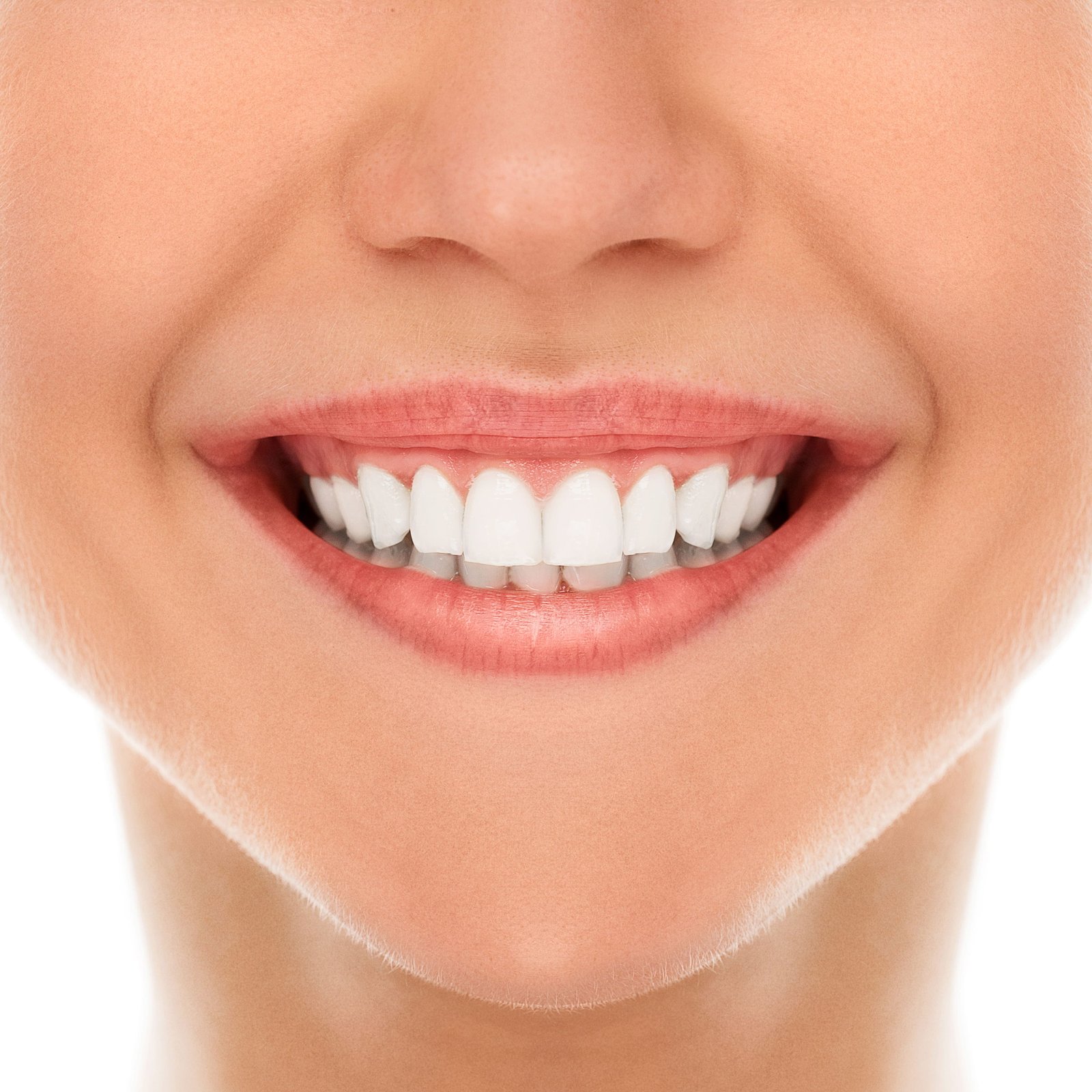 Best veneers teeth in Surat